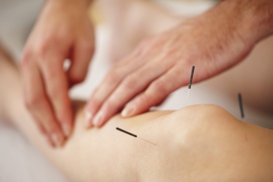 Dry Needling1